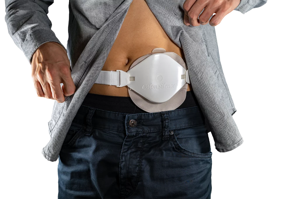 Mann mit grauem, aufgeknöpftem Hemd, der die ColonSilence Dämmkappe über einem Stomabeutel trägt.